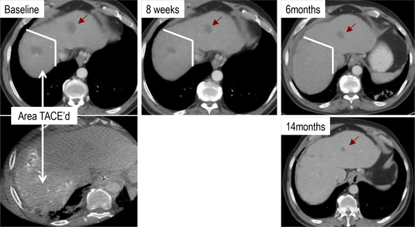 Figure 3: