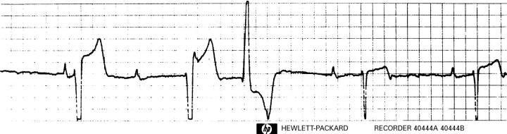 Figure 1  