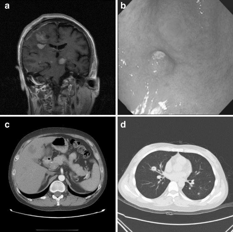 Fig. 1