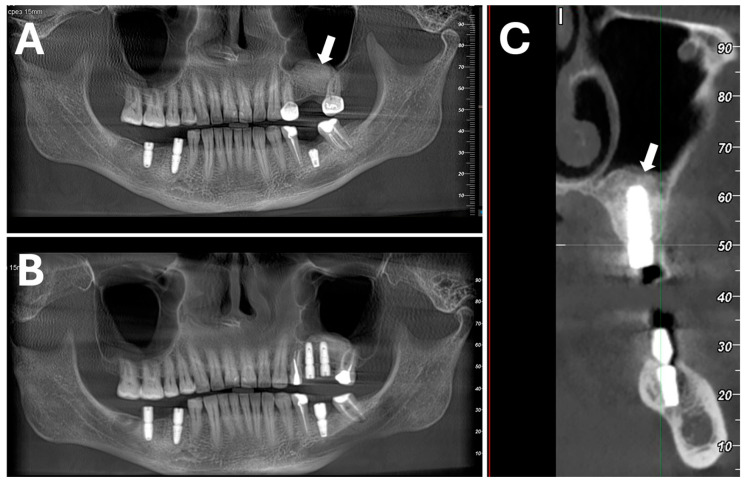 Figure 9