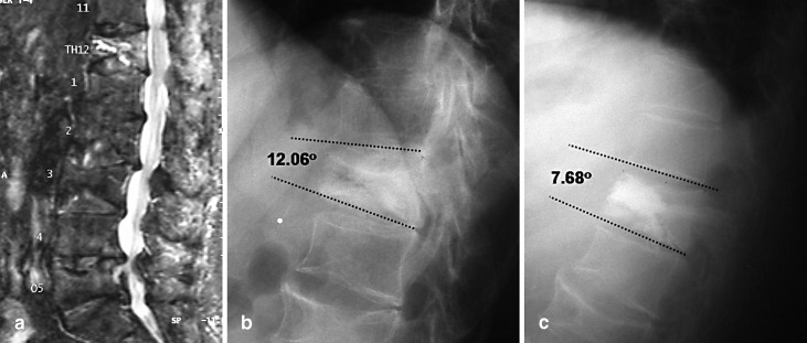  Fig. 3a–c