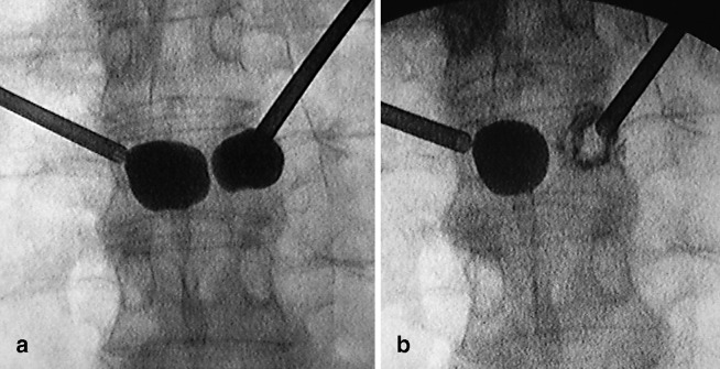  Fig. 11 a