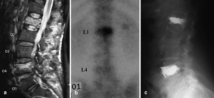  Fig. 2a–c