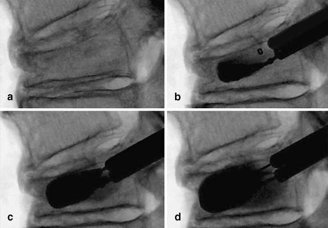  Fig. 4a–d