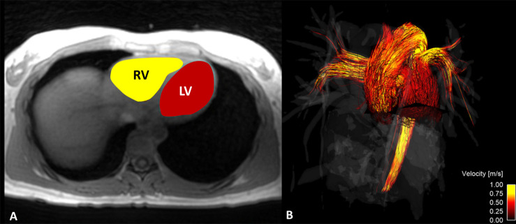 Figure 1: