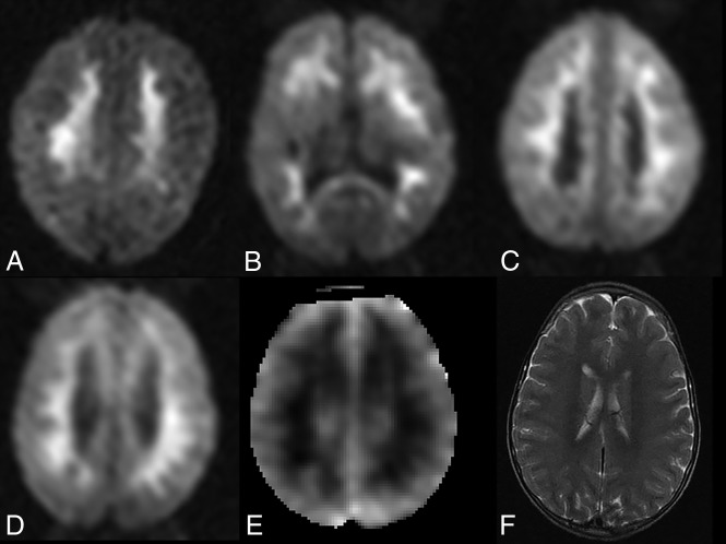 Fig 2.