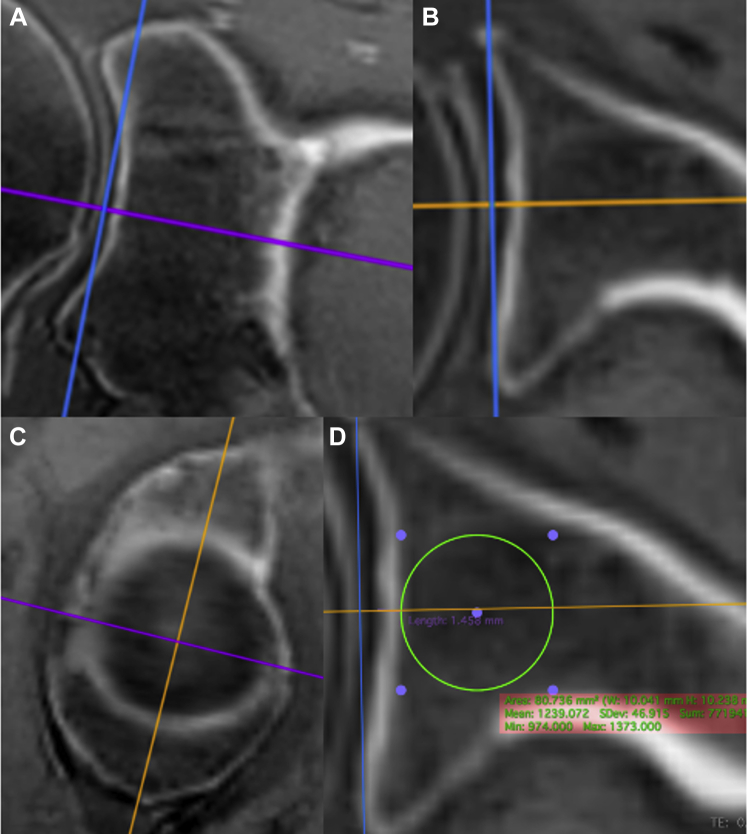 Figure 4