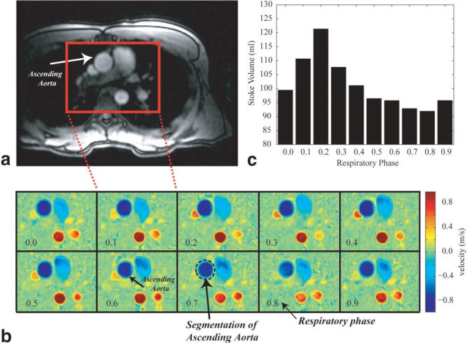 FIG. 6