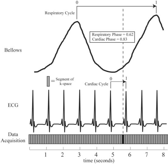 FIG. 1