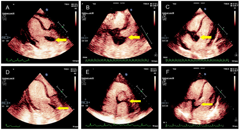 Figure 3