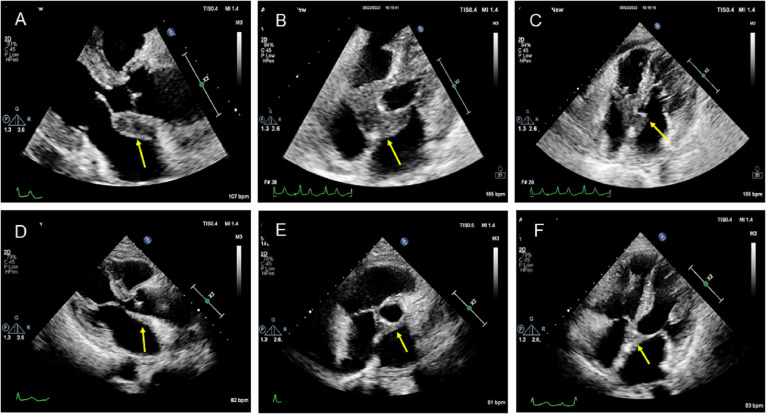 Figure 2