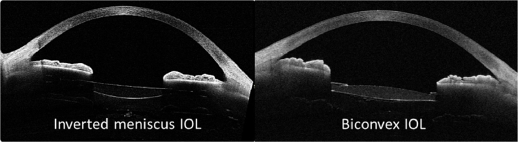 Fig. 18.