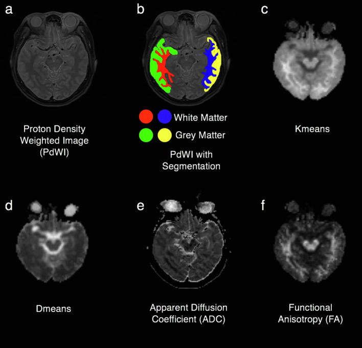 Fig. 2