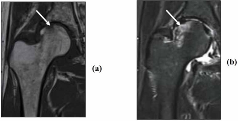 Fig. (5)