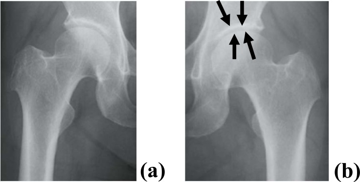 Fig. (1)