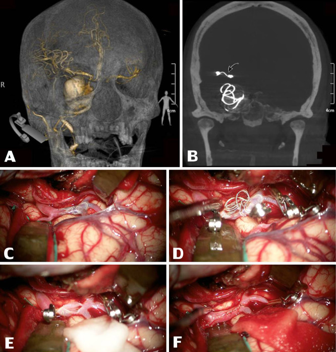 FIG. 2.