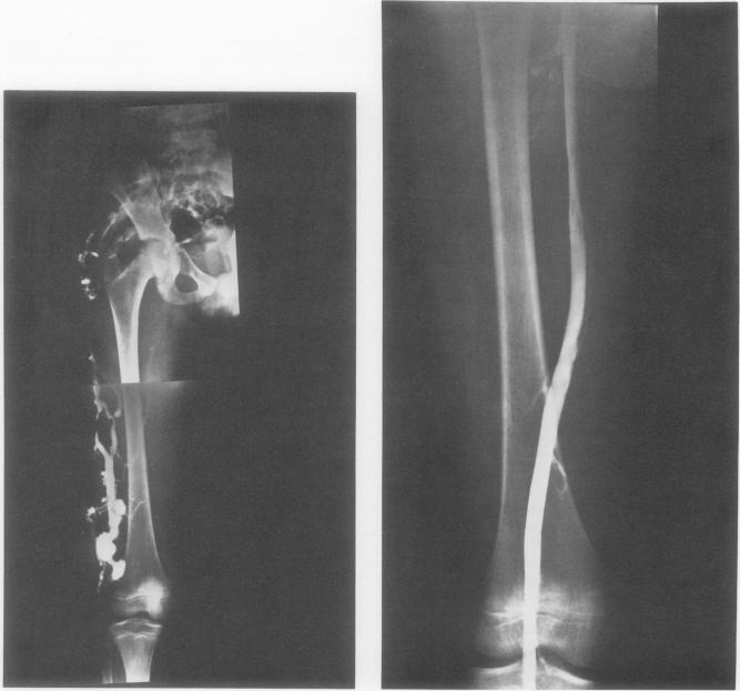 Fig. 5a and b.