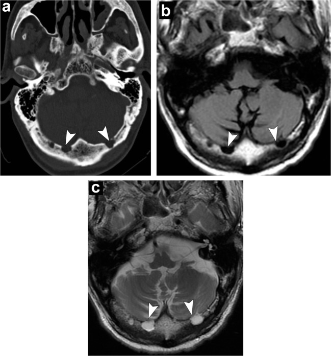 Fig. 23