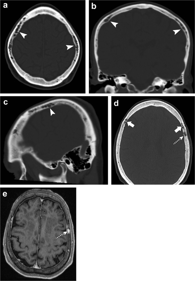 Fig. 24