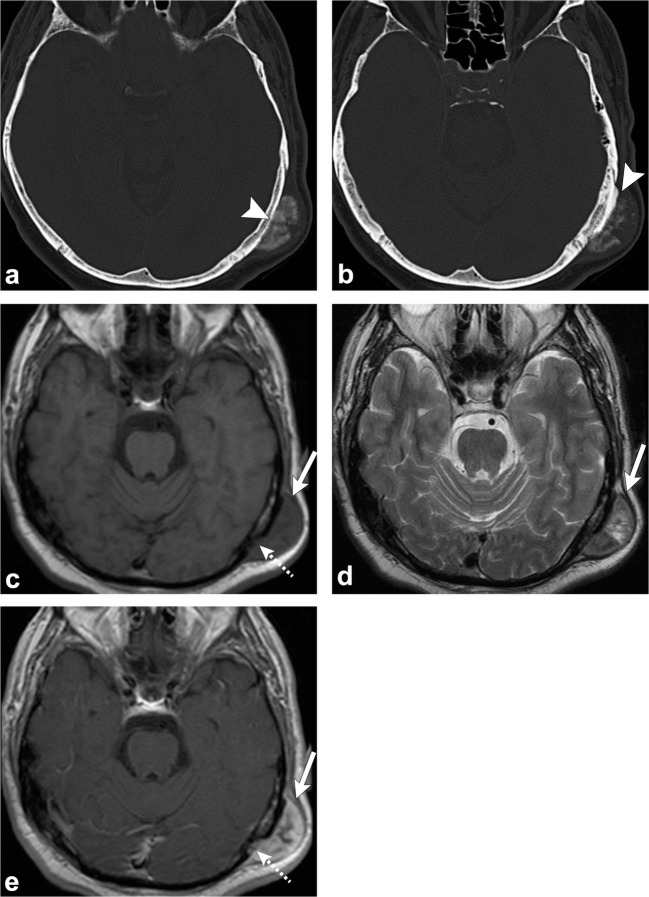 Fig. 17