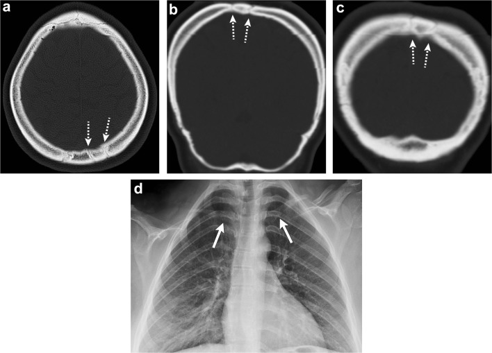 Fig. 15