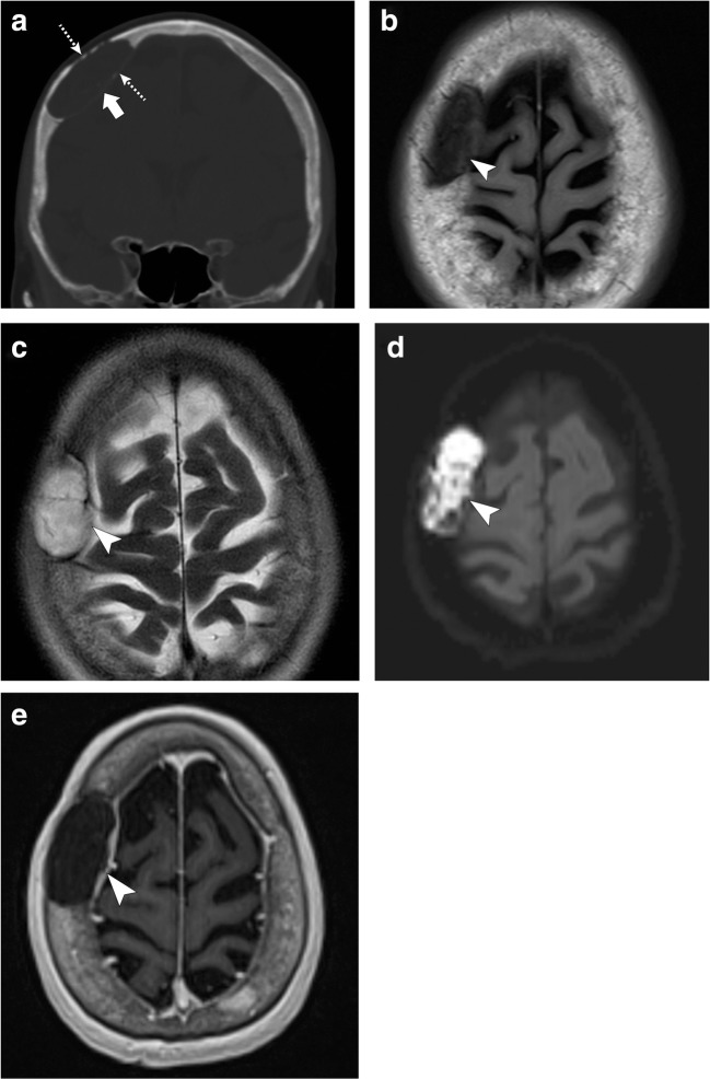 Fig. 13