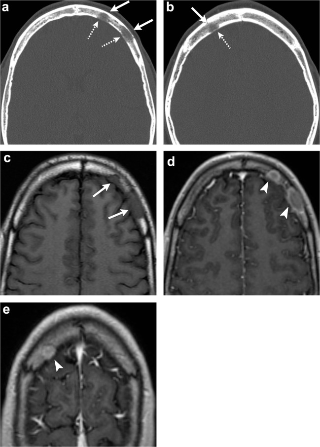 Fig. 11