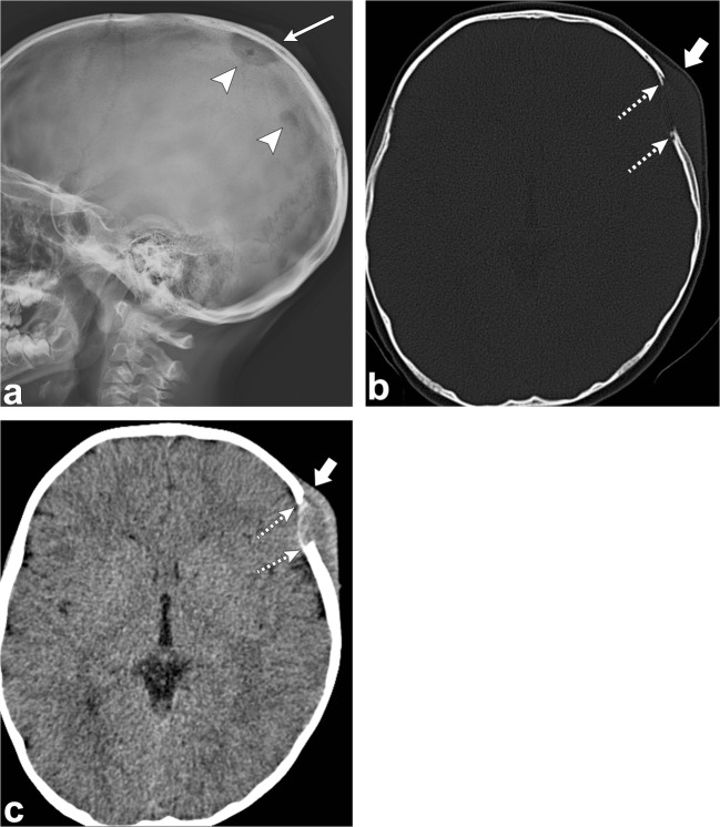 Fig. 5