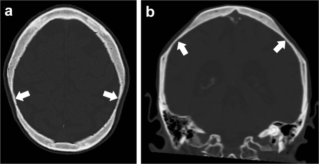 Fig. 26