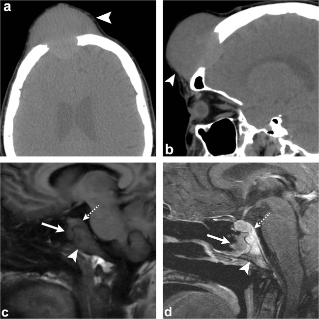 Fig. 18