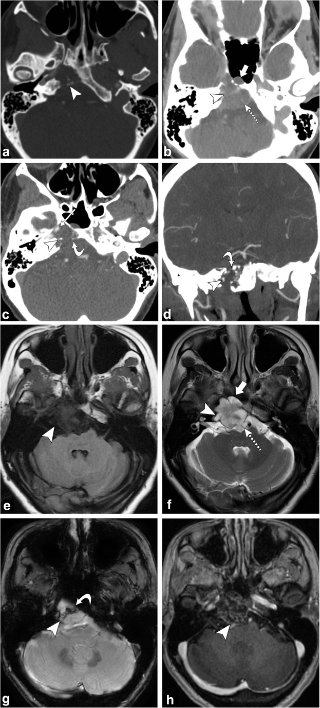 Fig. 20