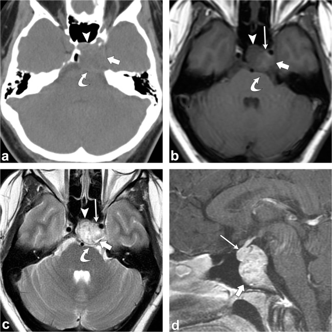 Fig. 19