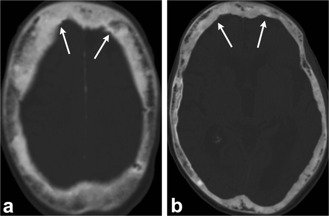 Fig. 10