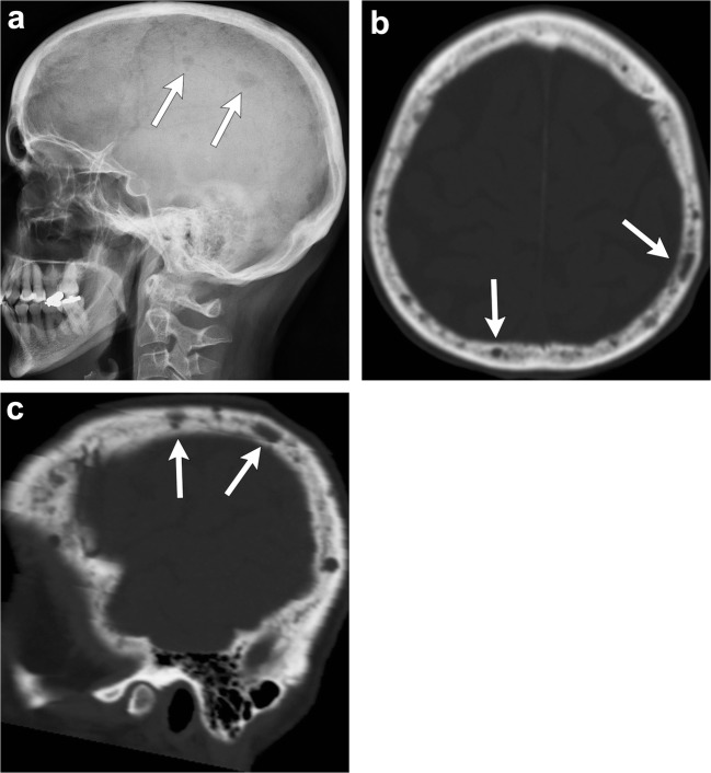 Fig. 16