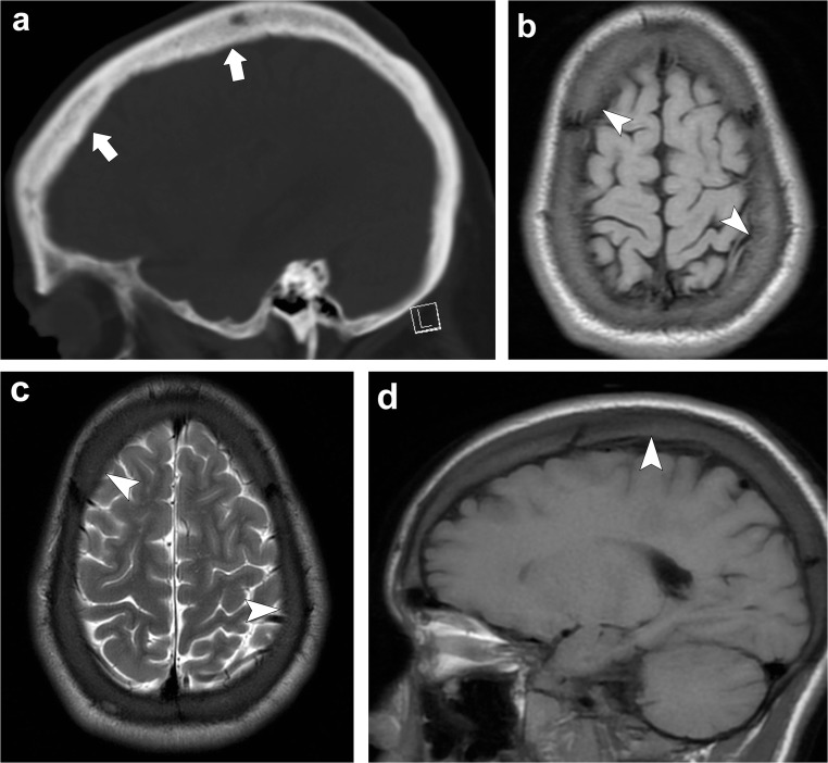 Fig. 21