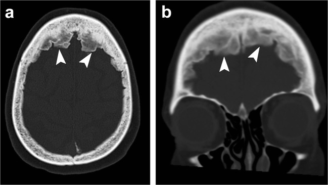 Fig. 25