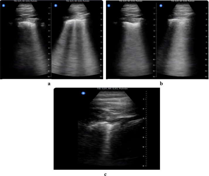 Fig 11