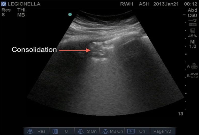 Fig 5