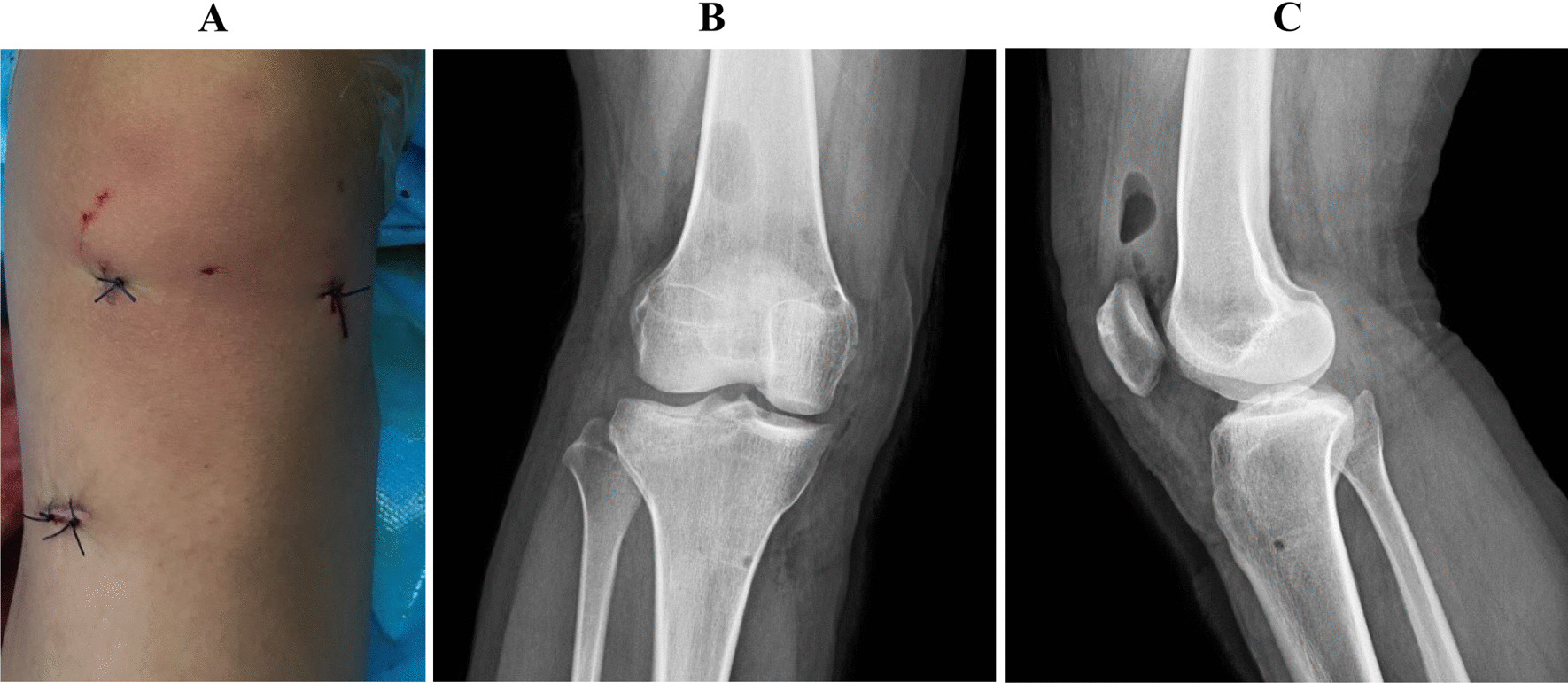 Fig. 5