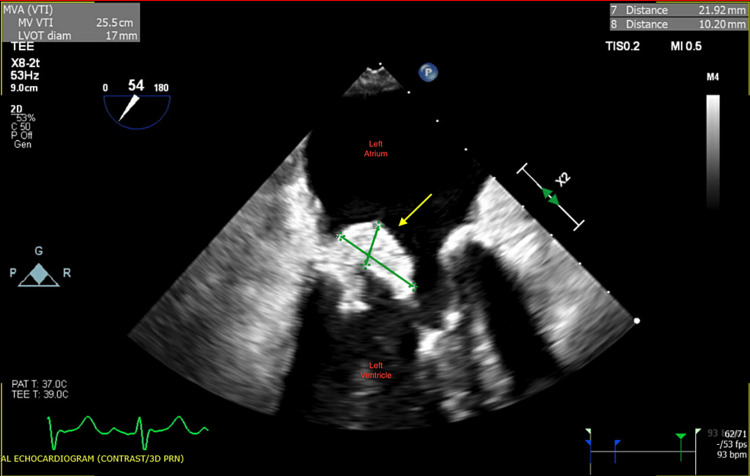 Figure 5