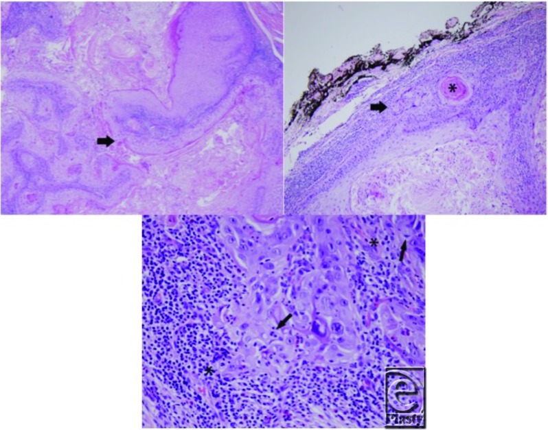 graphic file with name eplasty13ic44_fig1.jpg