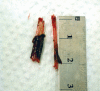 Figure 1.3: