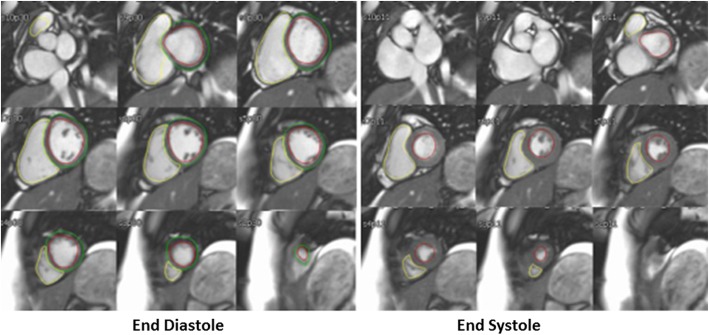 Fig. 2