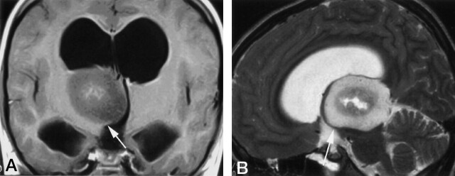 Fig 3.