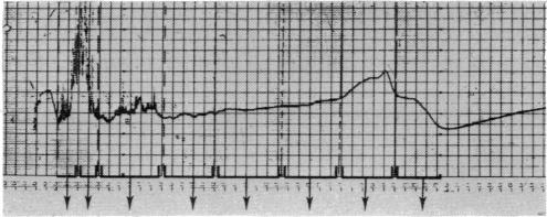 FIG. 7