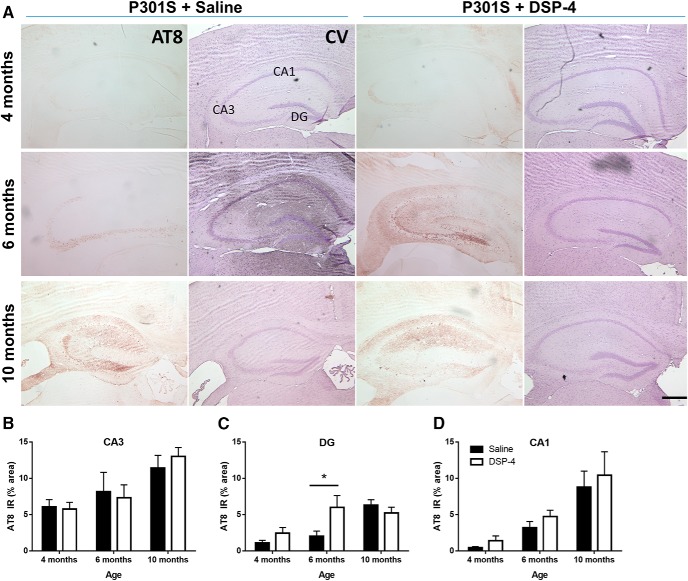 Figure 11.