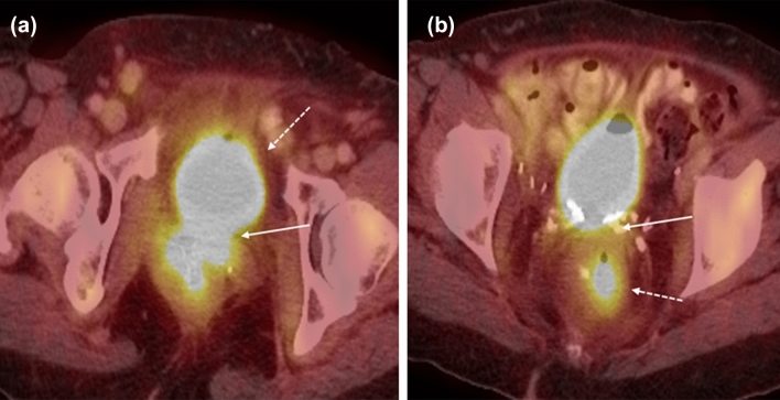 Fig. 13