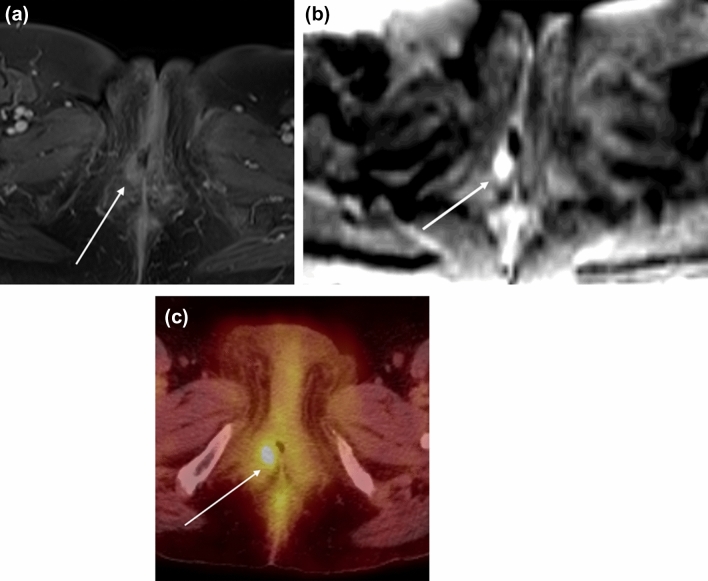 Fig. 7