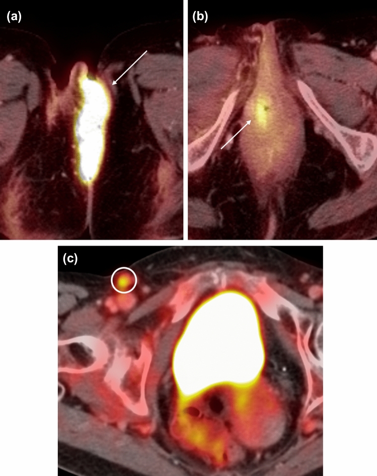 Fig. 4