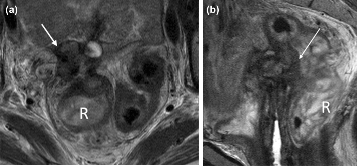 Fig. 12